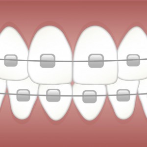 Praca dla Lekarza Ortodonty w prywatnej klinice stomatologicznej w Jeleniej Górze (woj. dolnośląskie)