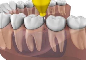 Quick Sleeper sprzedam opinie o sprzęcie