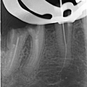 Skaner płytek fosforowych PSPiX jak DIGORA opinie o sprzęcie
