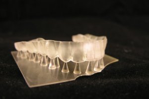 Drukarki dentystyczne 3D opinie o sprzęcie