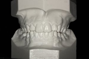 model_ortodontyczny.jpg