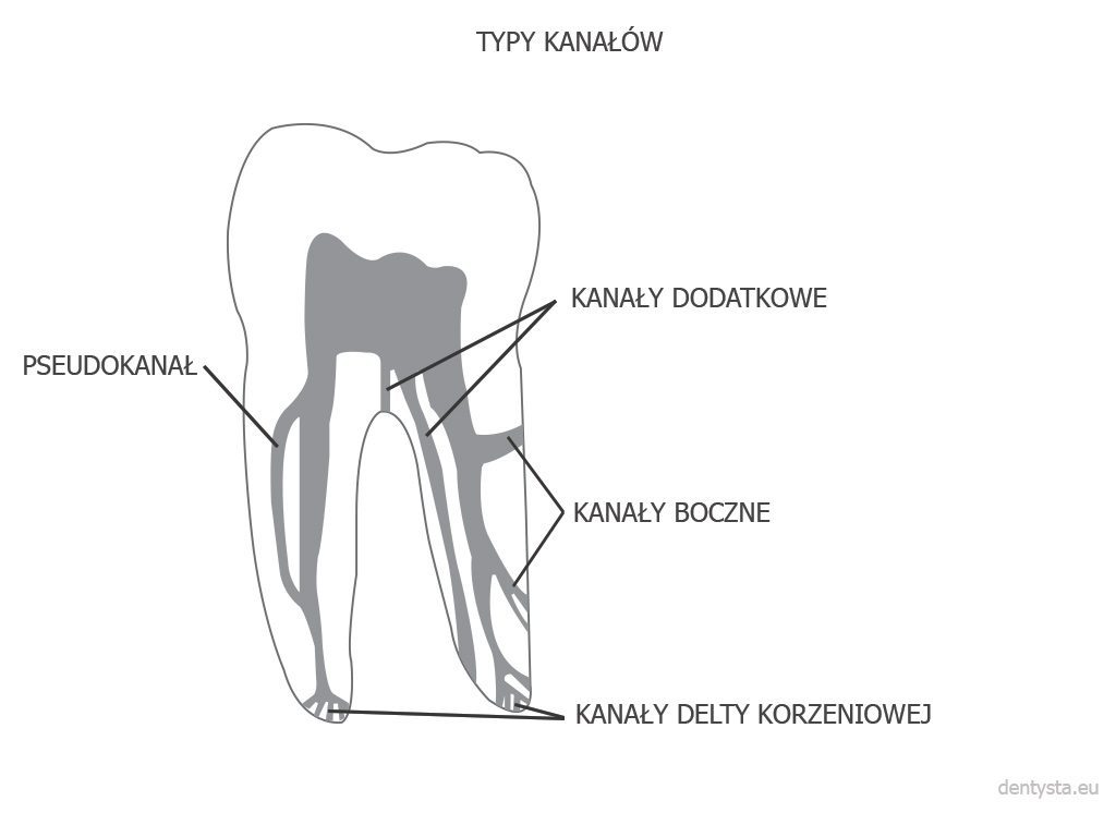 Różne rodzaj kanałów w zębie